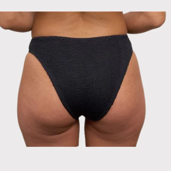 BIKINI CALAMOON MUJER - Image 3